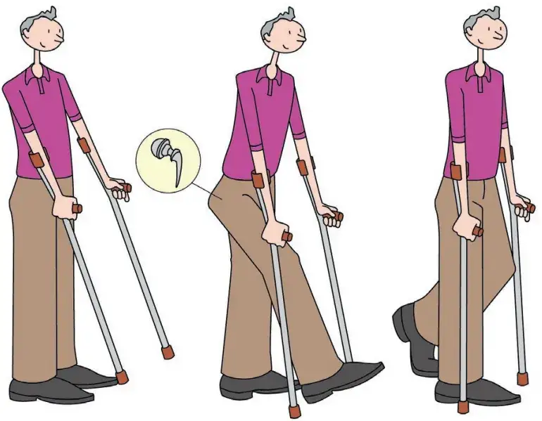 Zdjęcie Peut-on courir avec prothèse de hanche sans risque pour sa santé ?